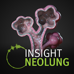 INSIGHT NEOLUNG